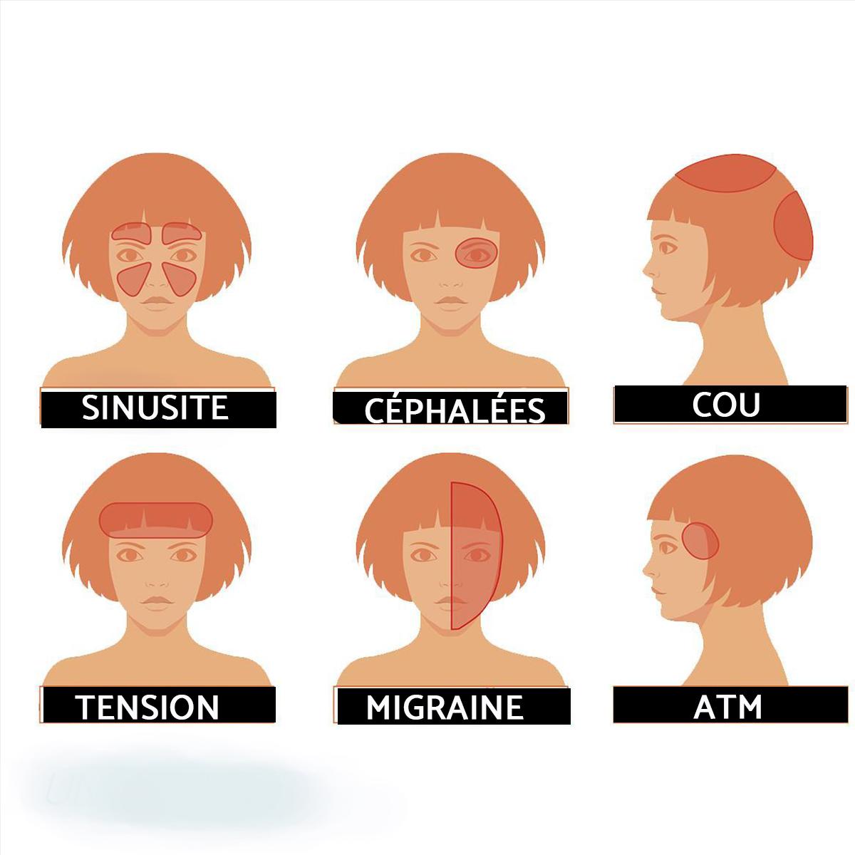 Quels sont les différents maux de tête - Images, symptômes et traitement !
