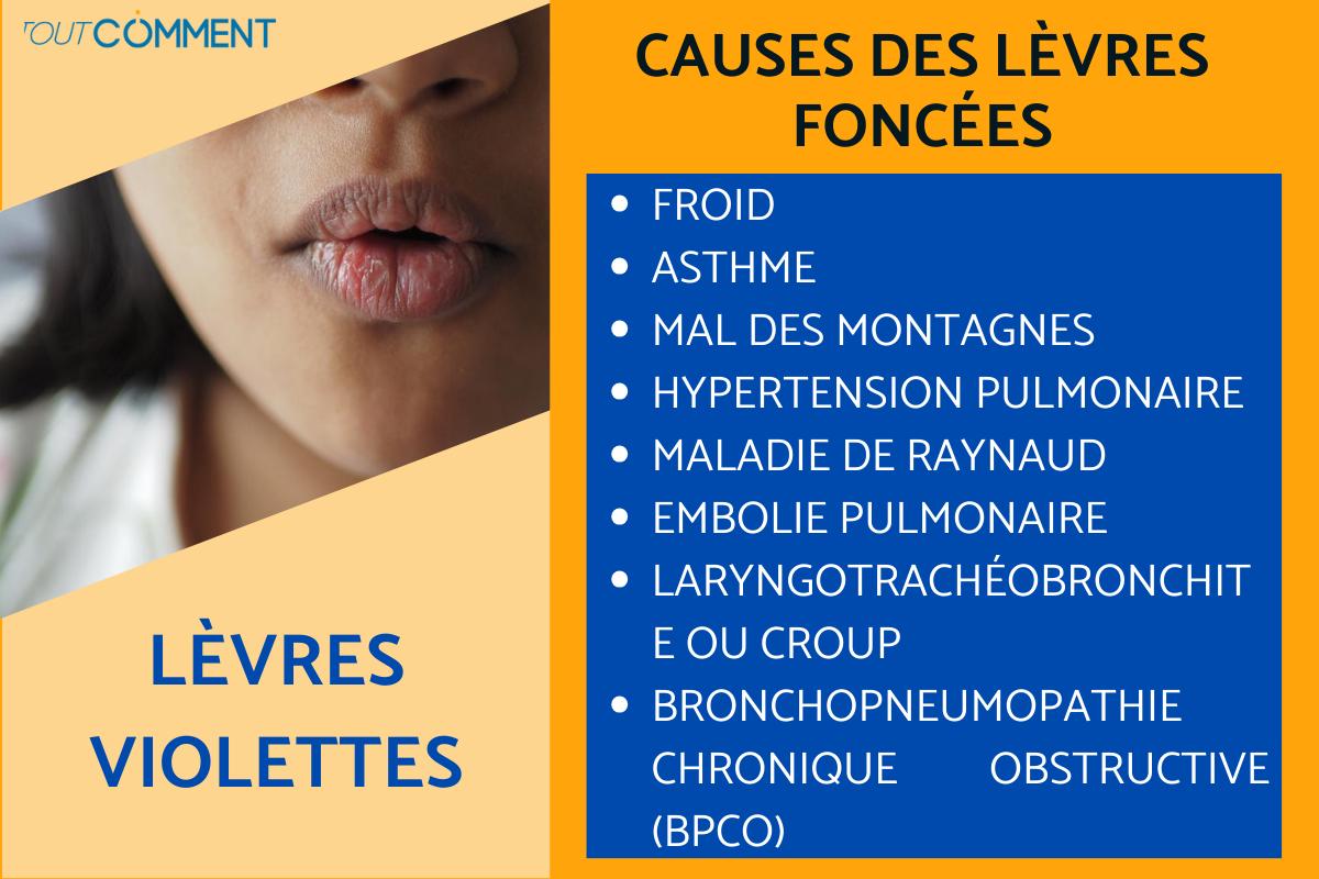 Causes des lèvres violettes