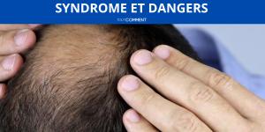 Finastéride : effets secondaires, syndrome et dangers