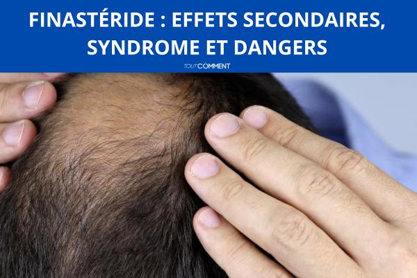 Finastéride : effets secondaires, syndrome et dangers
