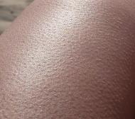 Comment éliminer la kétratose, la peau "chair de poule"