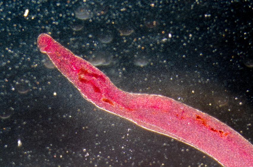 Comment guérir les oxyures naturellement