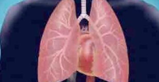 Remèdes contre la bronchite chronique