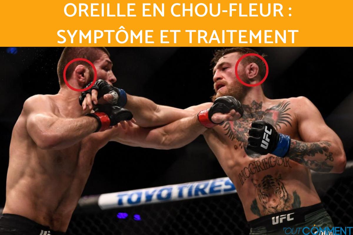 Oreille en chou-fleur ou de lutteur : comment les avoir et traitement