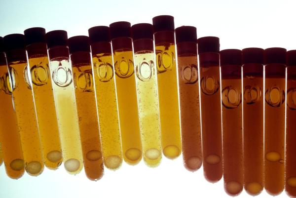 Pourquoi ai-je un taux d'hématocrite élevé