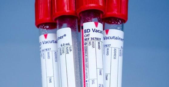 Pourquoi le taux de potassium augmente