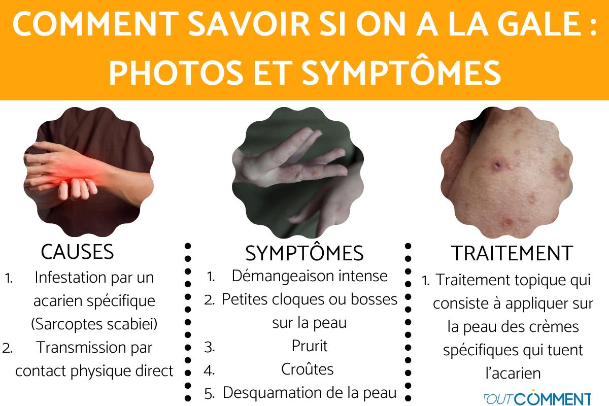 COMMENT SAVOIR si on a LA GALE : PHOTOS et SYMPTÔMES