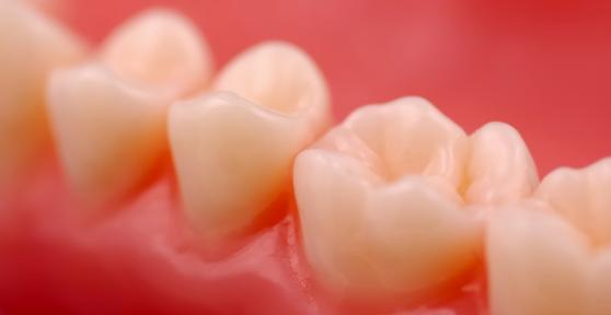 Comment soulager des gencives douloureuses