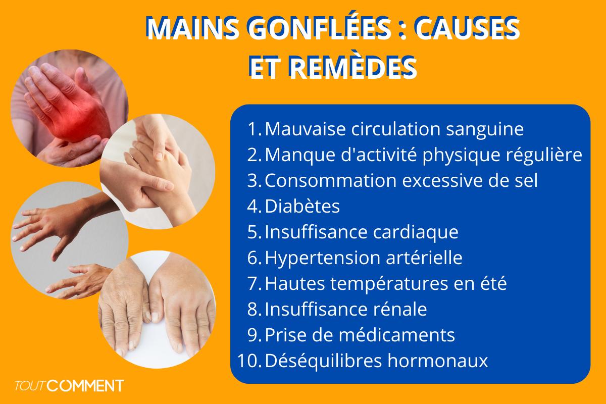 Mains gonflées : causes et remèdes