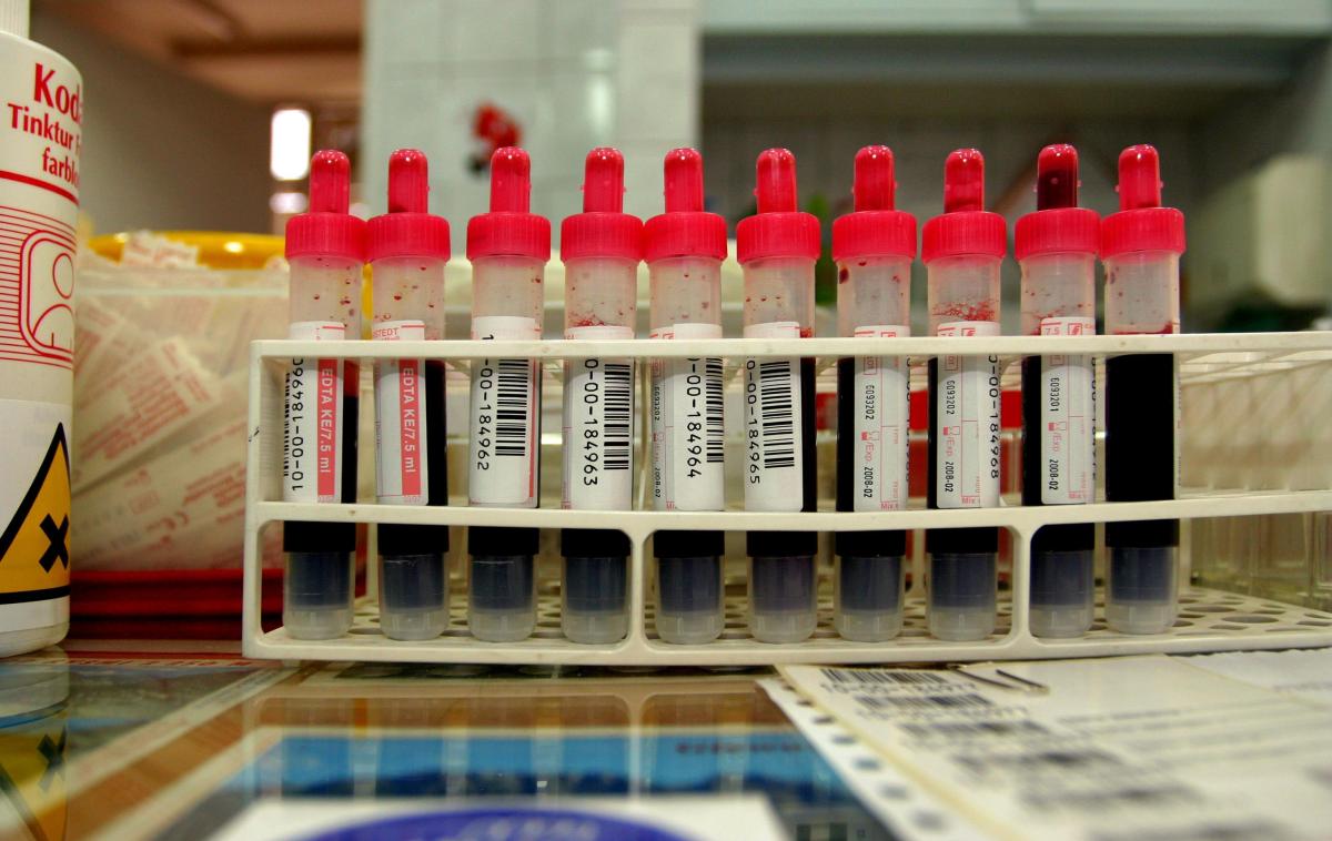 Quelles sont les causes d'une phosphatase alcaline basse