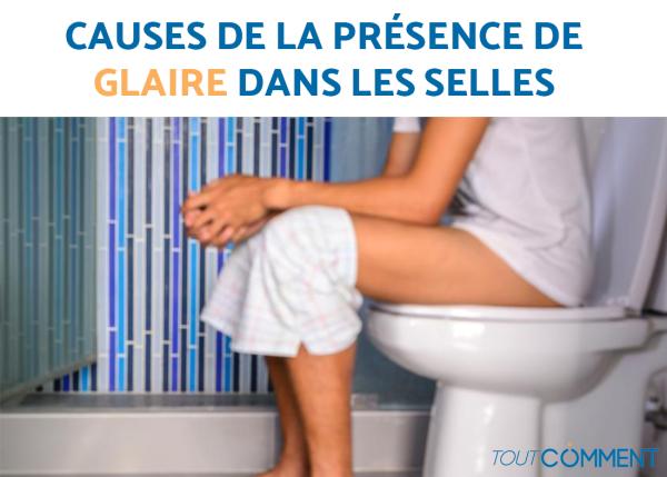 Causes de la présence de glaire dans les selles