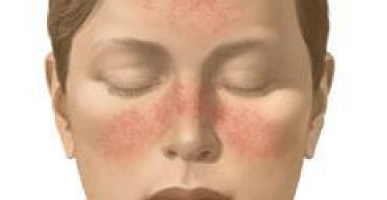 Comment faire un gommage pour une peau rosacée