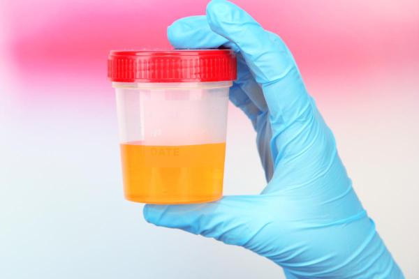 Pourquoi conserver ses urines au frigo ? - Comment conserver l'urine pour analyse ?