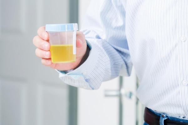Pourquoi conserver ses urines au frigo ? - Pourquoi conserver ses urines au frigo ?