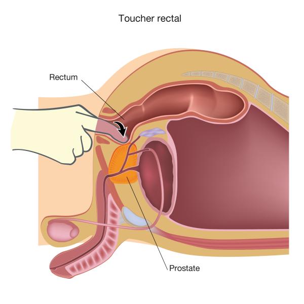 Comment examiner la prostate soi-même - Étape 6