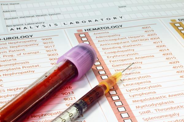 Comment examiner la prostate soi-même - Étape 8