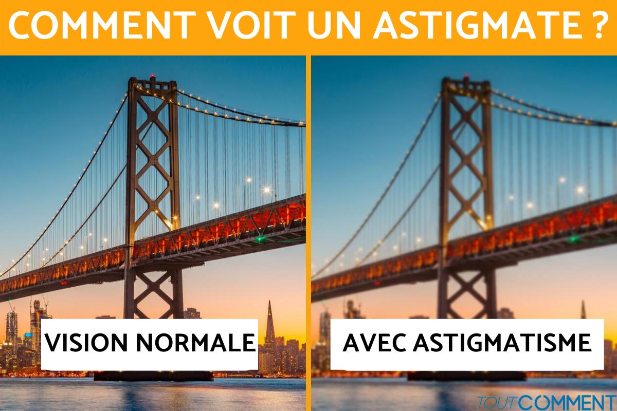 Comment voit un astigmate