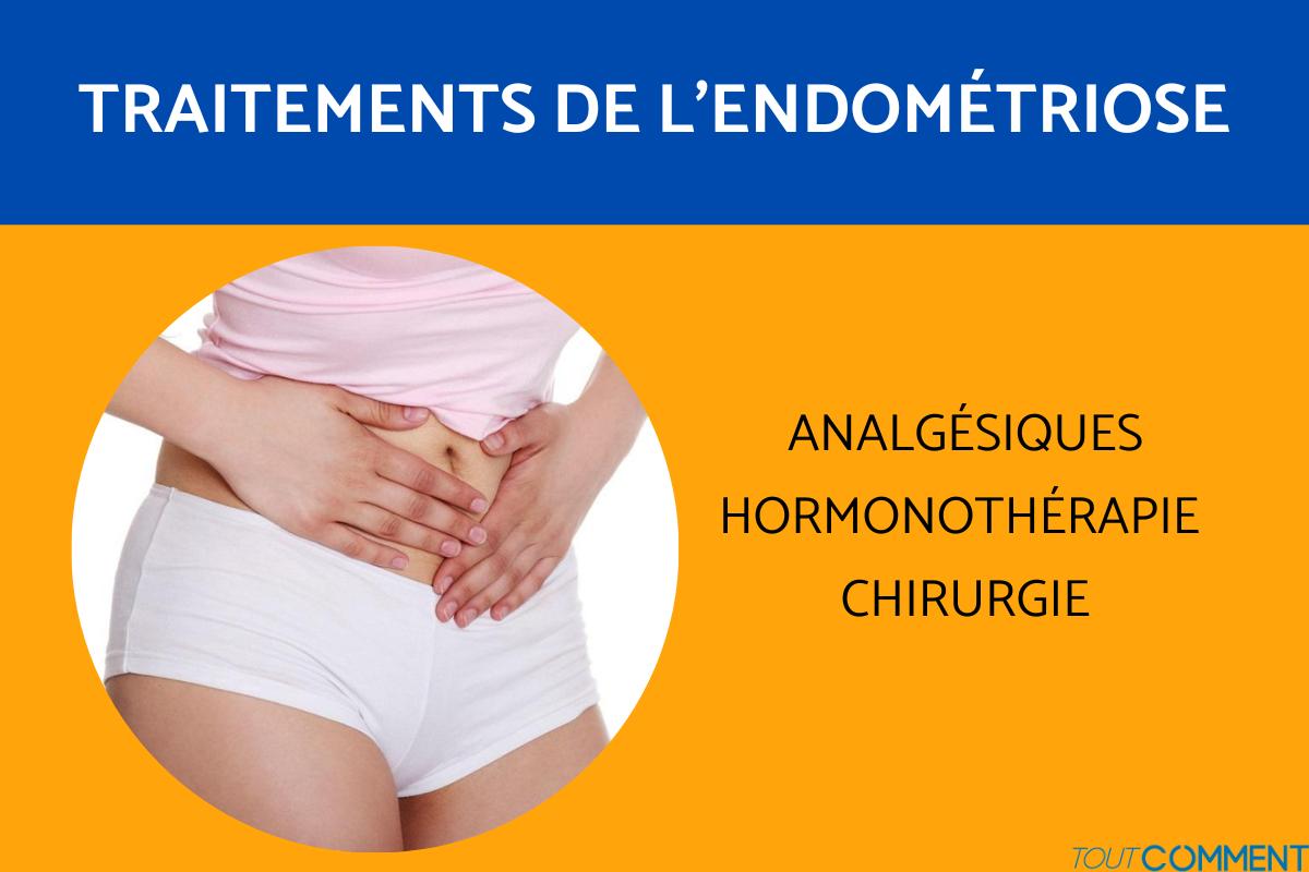 Comment traiter l'endométriose ?