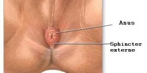 Comment traiter la fissure anale
