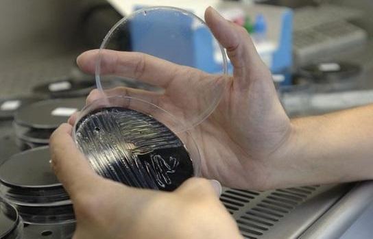 Quels sont les symptômes de la légionellose