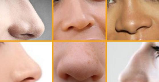 Différents types de nez