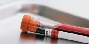 Quel est le taux normal de lymphocytes dans le sang