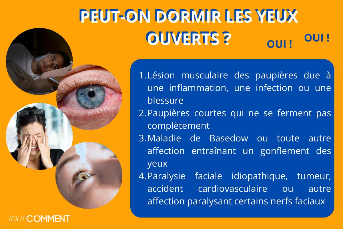 Peut-on dormir les yeux ouverts ?