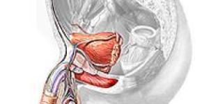 Comment traiter une grande prostate