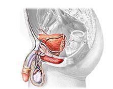 Comment traiter une grande prostate